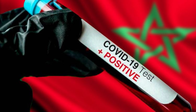 وزارة الصحة : المغرب يقتني رسميا 100 ألف تحليلة الكشف السريع عن “كورونا”