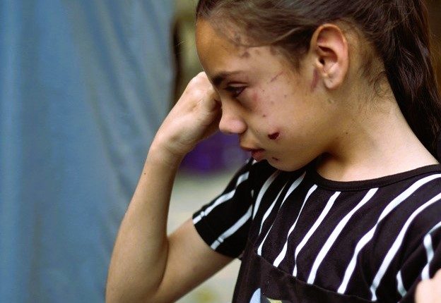 “ليس هناك إصابات فالجميع قد مات”… مأساة “تالا” طفلة فلسطينية
